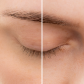 Avant / après sérum cils MÁDARA Long Lash : cils plus longs et plus fournis